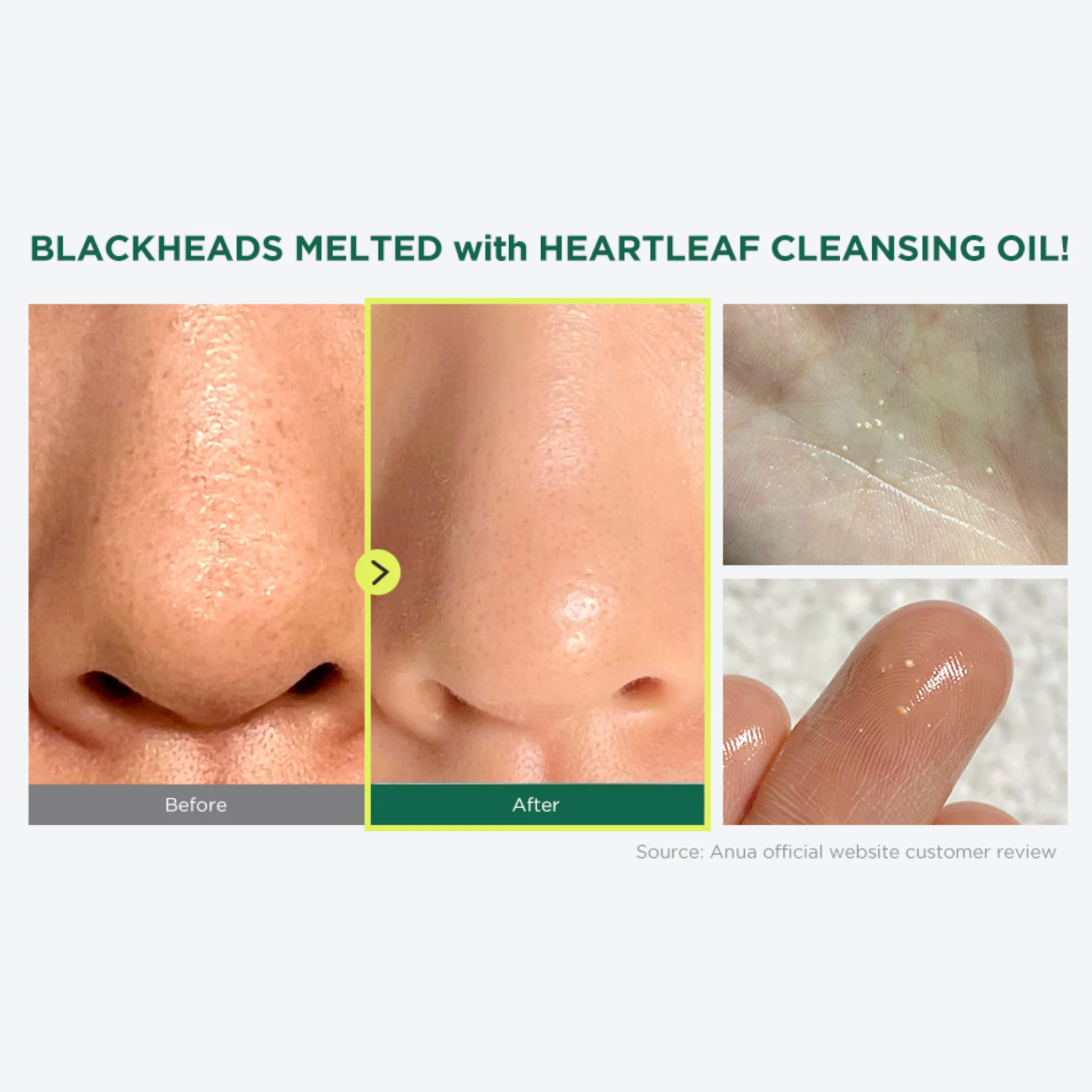Heartleaf Pore Control Cleansing Oil (200ml) - Image 4